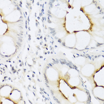CCL22 / MDC Antibody - Immunohistochemistry of paraffin-embedded human colon tissue.