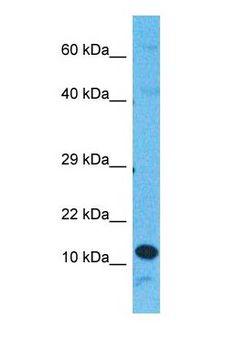 CCL23 / MIP3 Antibody - Western blot of CCL23 Antibody with human HepG2 Whole Cell lysate.  This image was taken for the unconjugated form of this product. Other forms have not been tested.