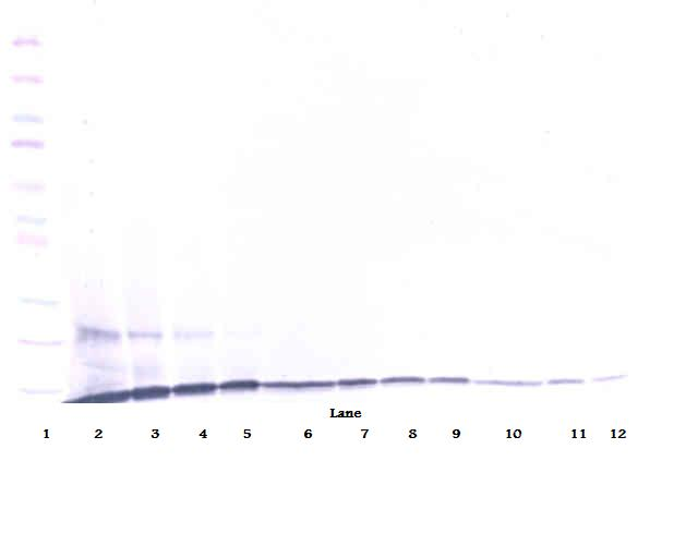 CCL23 / MIP3 Antibody - Anti-Human MIP-3 (CCL23) Western Blot Reduced