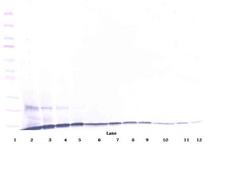 CCL23 / MIP3 Antibody - Anti-Human MIP-3 (CCL23) Western Blot Reduced