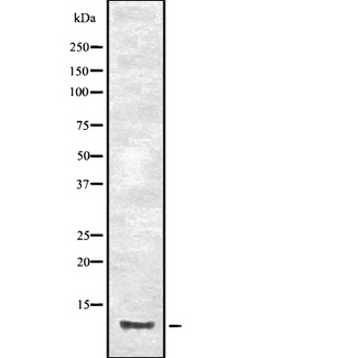 CCL23 / MIP3 Antibody - Western blot analysis of CCL23 expression in HEK293 cells. The lane on the left is treated with the antigen-specific peptide.