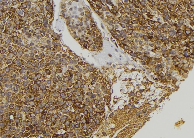 CCL23 / MIP3 Antibody - 1:100 staining human pancreas tissue by IHC-P. The sample was formaldehyde fixed and a heat mediated antigen retrieval step in citrate buffer was performed. The sample was then blocked and incubated with the antibody for 1.5 hours at 22°C. An HRP conjugated goat anti-rabbit antibody was used as the secondary.