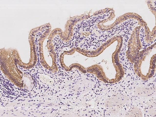 CCL23 / MIP3 Antibody - Immunochemical staining of human CCL23 in human gallbladder with rabbit polyclonal antibody at 1:100 dilution, formalin-fixed paraffin embedded sections.