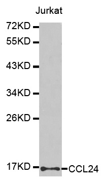 CCL24 / Eotaxin 2 Antibody - Western blot analysis of extracts of Jurkat cells.