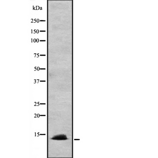 CCL24 / Eotaxin 2 Antibody - Western blot analysis of CCL24 expression in HEK293 cells. The lane on the left is treated with the antigen-specific peptide.