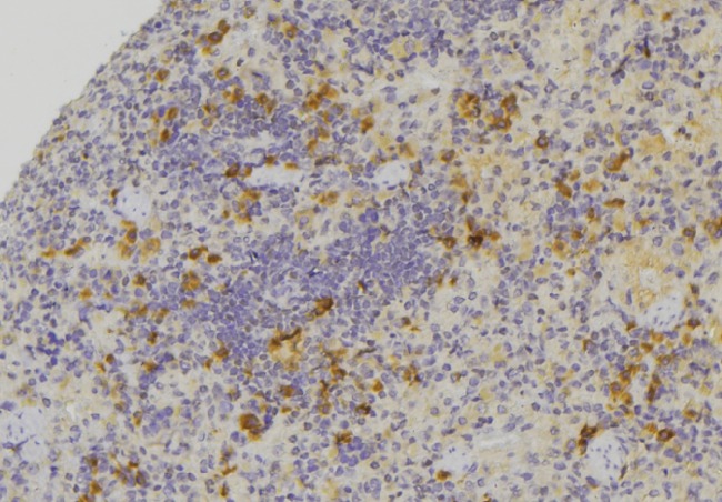 CCL24 / Eotaxin 2 Antibody - 1:100 staining human lymph node tissue by IHC-P. The sample was formaldehyde fixed and a heat mediated antigen retrieval step in citrate buffer was performed. The sample was then blocked and incubated with the antibody for 1.5 hours at 22°C. An HRP conjugated goat anti-rabbit antibody was used as the secondary.