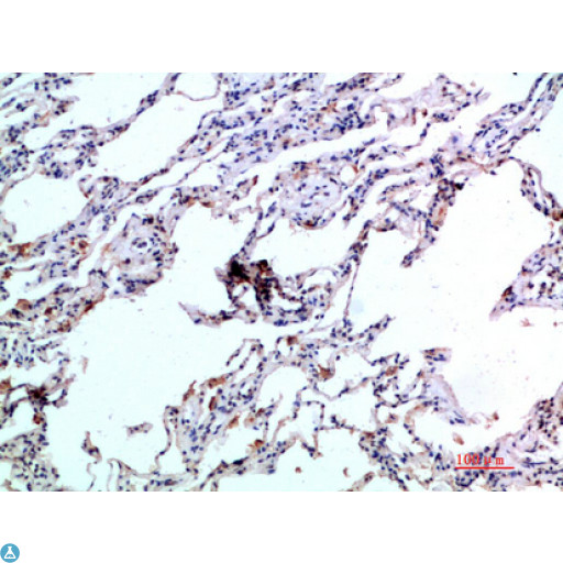 CCL24 / Eotaxin 2 Antibody - Immunohistochemical analysis of paraffin-embedded human-lung, antibody was diluted at 1:200.