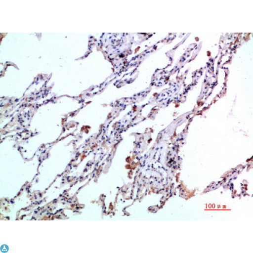 CCL24 / Eotaxin 2 Antibody - Immunohistochemical analysis of paraffin-embedded human-lung, antibody was diluted at 1:200.