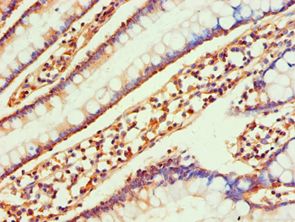 CCL25 / TECK Antibody - Immunohistochemistry of paraffin-embedded human small intestine using antibody at 1:100 dilution.
