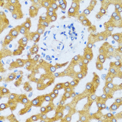 CCL25 / TECK Antibody - Immunohistochemistry of paraffin-embedded human liver tissue.