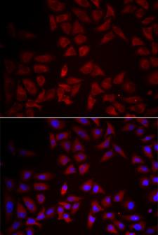 CCL25 / TECK Antibody - Immunofluorescence analysis of HeLa cells.