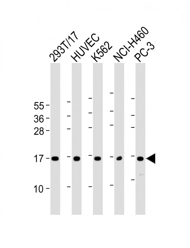 CCL26 / Eotaxin 3 Antibody - All lanes: Anti-CCL26 Antibody (C-Term) at 1:2000 dilution Lane 1: 293T/17 whole cell lysate Lane 2: HUVEC whole cell lysate Lane 3: K562 whole cell lysate Lane 4: NCI-H460 whole cell lysate Lane 5: PC-3 whole cell lysate Lysates/proteins at 20 µg per lane. Secondary Goat Anti-Rabbit IgG, (H+L), Peroxidase conjugated at 1/10000 dilution. Predicted band size: 11 kDa Blocking/Dilution buffer: 5% NFDM/TBST.