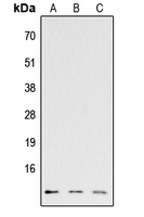 CCL26 / Eotaxin 3 Antibody - Western blot analysis of CCL26 expression in HEK293T (A); Raw264.7 (B); H9C2 (C) whole cell lysates.