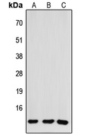 CCL26 / Eotaxin 3 Antibody - Western blot analysis of CCL26 expression in HEK293T (A); NS-1 (B); H9C2 (C) whole cell lysates.