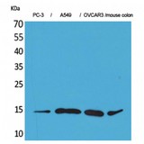 CCL26 / Eotaxin 3 Antibody - Western blot of Eotaxin-3 antibody
