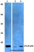 CCL26 / Eotaxin 3 Antibody - Western blot of CCL26 antibody at 1:500 dilution. Lane 1: HEK293T whole cell lysate. Lane 2: sp2/0 whole cell lysate. Lane 3: H9C5 whole cell lysate.