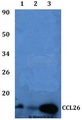 CCL26 / Eotaxin 3 Antibody - Western blot of CCL26 antibody at 1:500 dilution. Lane 1: HEK293T whole cell lysate. Lane 2: RAW264.7 whole cell lysate.