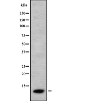 CCL26 / Eotaxin 3 Antibody - Western blot analysis of CCL26 using COLO205 whole cells lysates