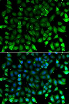 CCL26 / Eotaxin 3 Antibody - Immunofluorescence analysis of A549 cells using CCL26 Polyclonal Antibody.