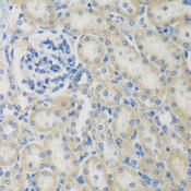 CCL26 / Eotaxin 3 Antibody - Immunohistochemistry of paraffin-embedded Rat kidney using CCL26 Polyclonal Antibody at dilution of 1:200 (40x lens).