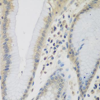 CCL26 / Eotaxin 3 Antibody - Immunohistochemistry of paraffin-embedded Human stomach using CCL26 Polyclonal Antibody at dilution of 1:200 (40x lens).