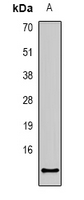 CCL27 Antibody - Western blot analysis of CCL27 expression in mouse kidney (A) whole cell lysates.