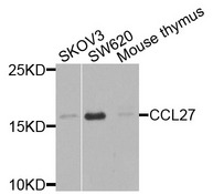 CCL27 Antibody - Western blot analysis of extracts of various cells.