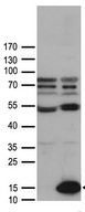 CCL27 Antibody - HEK293T cells were transfected with the pCMV6-ENTRY control. (Left lane) or pCMV6-ENTRY CCL27. (Right lane) cDNA for 48 hrs and lysed