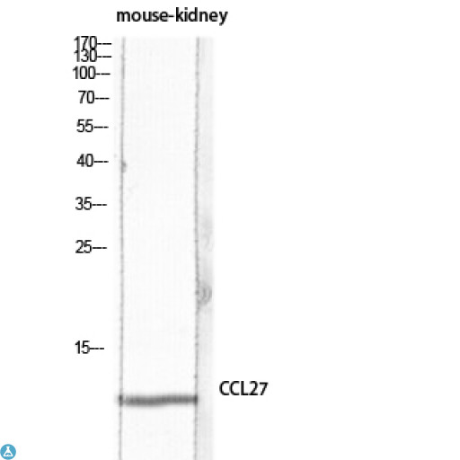 CCL27 Antibody - Western Blot (WB) analysis of Mouse Kidney lysis using CCL27 antibody.