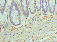 CCL28 / MEC Antibody - Immunohistochemistry of paraffin-embedded human colon tissue using CCL28 Antibody at dilution of 1:100