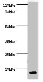 CCL28 / MEC Antibody - Western blot All lanes: C-C motif chemokine 28 antibody at 5µg/ml + Mouse spleen tissue Secondary Goat polyclonal to rabbit IgG at 1/10000 dilution Predicted band size: 15, 13 kDa Observed band size: 15 kDa