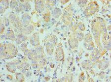 CCL28 / MEC Antibody - Immunohistochemistry of paraffin-embedded human salivary gland using antibody at 1:100 dilution.