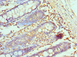 CCL28 / MEC Antibody - Immunohistochemistry of paraffin-embedded human colon tissue using CCL28 Antibody at dilution of 1:100