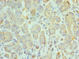 CCL28 / MEC Antibody - Immunohistochemistry of paraffin-embedded human salivary gland tissue using CCL28 Antibody at dilution of 1:100