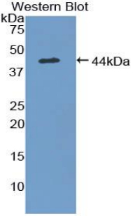 CCL28 / MEC Antibody - Western blot of recombinant CCL28 / MEC.
