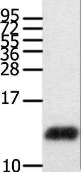 CCL28 / MEC Antibody - Western blot analysis of Human brain glioma tissue, using CCL28 Polyclonal Antibody at dilution of 1:450.