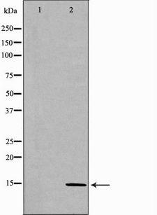CCL28 / MEC Antibody - Western blot analysis of mouse spleen lysate using CCL28 antibody. The lane on the left is treated with the antigen-specific peptide.