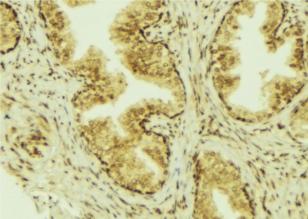 CCL28 / MEC Antibody - 1:100 staining mouse colon tissue by IHC-P. The sample was formaldehyde fixed and a heat mediated antigen retrieval step in citrate buffer was performed. The sample was then blocked and incubated with the antibody for 1.5 hours at 22°C. An HRP conjugated goat anti-rabbit antibody was used as the secondary.