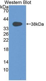 CCL3 / MIP-1-Alpha Antibody - Western blot of CCL3 / MIP-1-Alpha antibody.