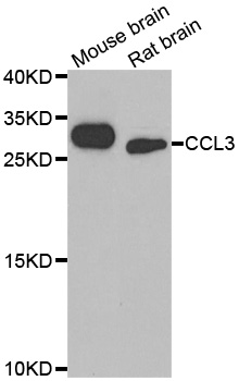 CCL3 / MIP-1-Alpha Antibody - Western blot analysis of extracts of various cell lines.