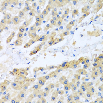 CCL3 / MIP-1-Alpha Antibody - Immunohistochemistry of paraffin-embedded human liver tissue.