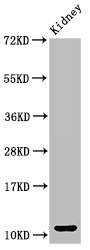CCL3 / MIP-1-Alpha Antibody - Positive WB detected in:Mouse kidney tissue;All lanes:CCL3 antibody at 3?g/ml;Secondary;Goat polyclonal to rabbit IgG at 1/50000 dilution;Predicted band size: 11 KDa;Observed band size: 11 KDa;