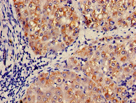 CCL3 / MIP-1-Alpha Antibody - Immunohistochemistry of paraffin-embedded human liver tissue using CCL3 Antibody at dilution of 1:100