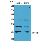CCL4 / MIP-1 Beta Antibody - Western blot of MIP-1beta antibody