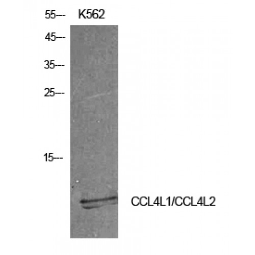 CCL4 / MIP-1 Beta Antibody - Western blot of MIP-1b antibody