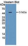 CCL4 / MIP-1 Beta Antibody - Western blot of CCL4 / MIP-1 Beta antibody using recombinant CCL4 with a GST tag.