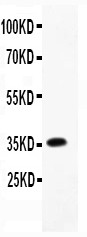 CCL4 / MIP-1 Beta Antibody - CCL4 antibody Western blot. All lanes: Anti-CCL4 at 0.5 ug/ml. WB: Recombinant Rat CCL4 Protein 0.5ng . Predicted band size: 36 kD. Observed band size: 36 kD.