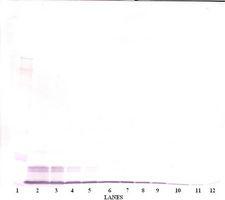 CCL4 / MIP-1 Beta Antibody - Western Blot (non-reducing) of CCL4 antibody. This image was taken for the unconjugated form of this product. Other forms have not been tested.