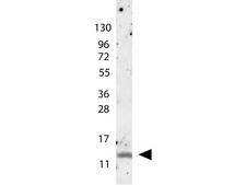 CCL4 / MIP-1 Beta Antibody - Anti-MIP-1beta Antibody - Western Blot. anti-Human MIP-1beta antibody shows detection of a band ~15 kD in size corresponding to recombinant human MIP-1beta. The identity of the faint higher molecular weight band may represent a homodimer. Molecular weight markers are also shown (left). After transfer, the membrane was blocked overnight with 3% BSA in TBS followed by reaction with primary antibody at a 1:1000 dilution. Detection occurred using peroxidase conjugated anti-Rabbit IgG (LS-C60865) secondary antibody diluted 1:40000 in blocking buffer (p/n MB-070) for 30 min at RT followed by reaction with FemtoMax chemiluminescent substrate. Image was captured using VersaDoc MP 4000 imaging system (Bio-Rad).