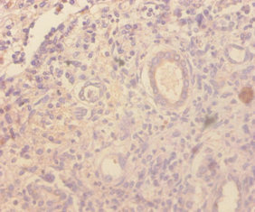 CCL4 / MIP-1 Beta Antibody - Immunohistochemistry of paraffin-embedded human kidney tissue using Ccl4 Antibody at dilution of 1:100